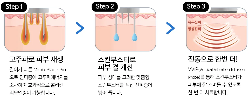 그림