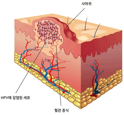 그림